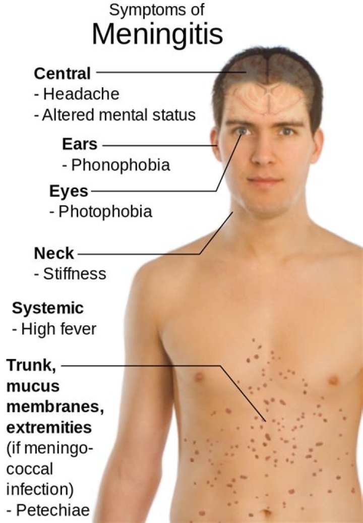 Can a person survive meningitis?