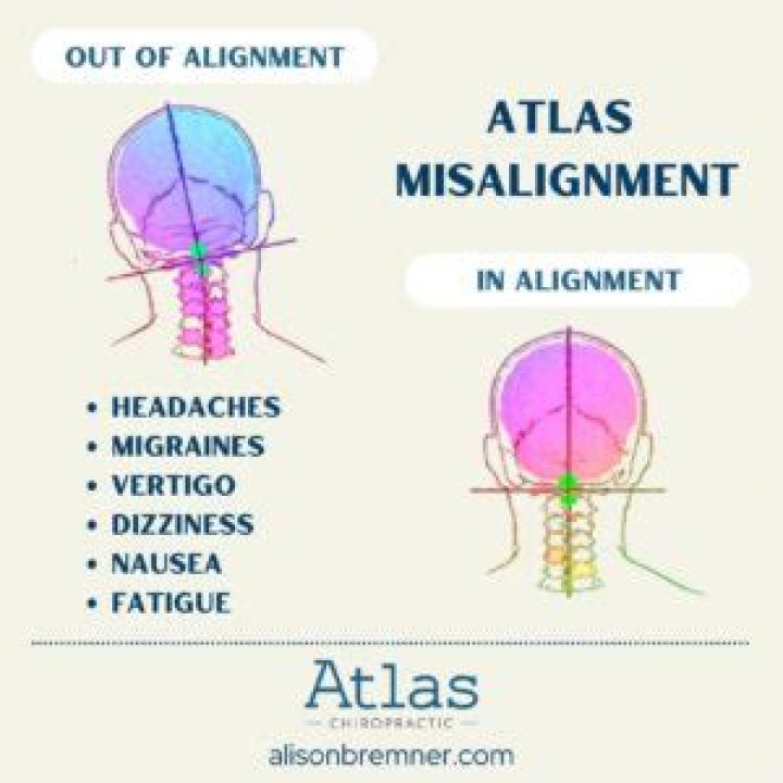 Can spinal misalignment cause vision problems?