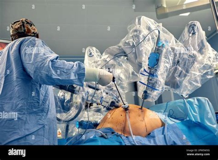 How long does robotic diverticulitis surgery take?