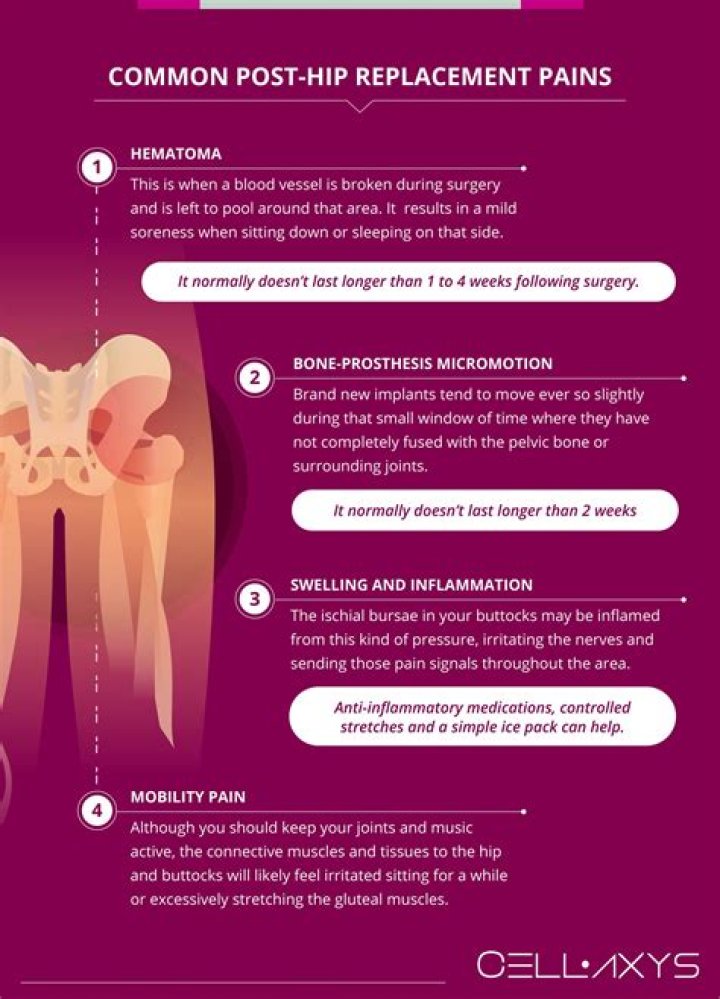 How Long Will my leg be swollen after hip replacement?