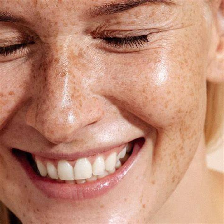 What is a dominance smile?