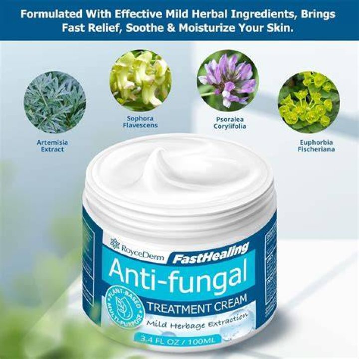 What is the strongest over-the-counter antifungal cream?