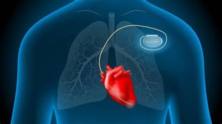 What should you avoid if you have a pacemaker?