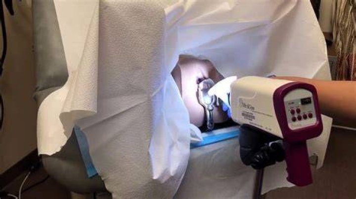 What will my colposcopy biopsy show?