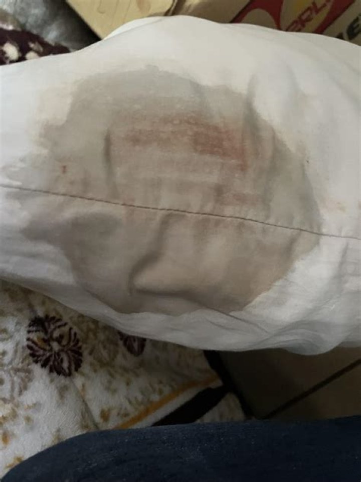 Why do I wake with blood on my pillow?
